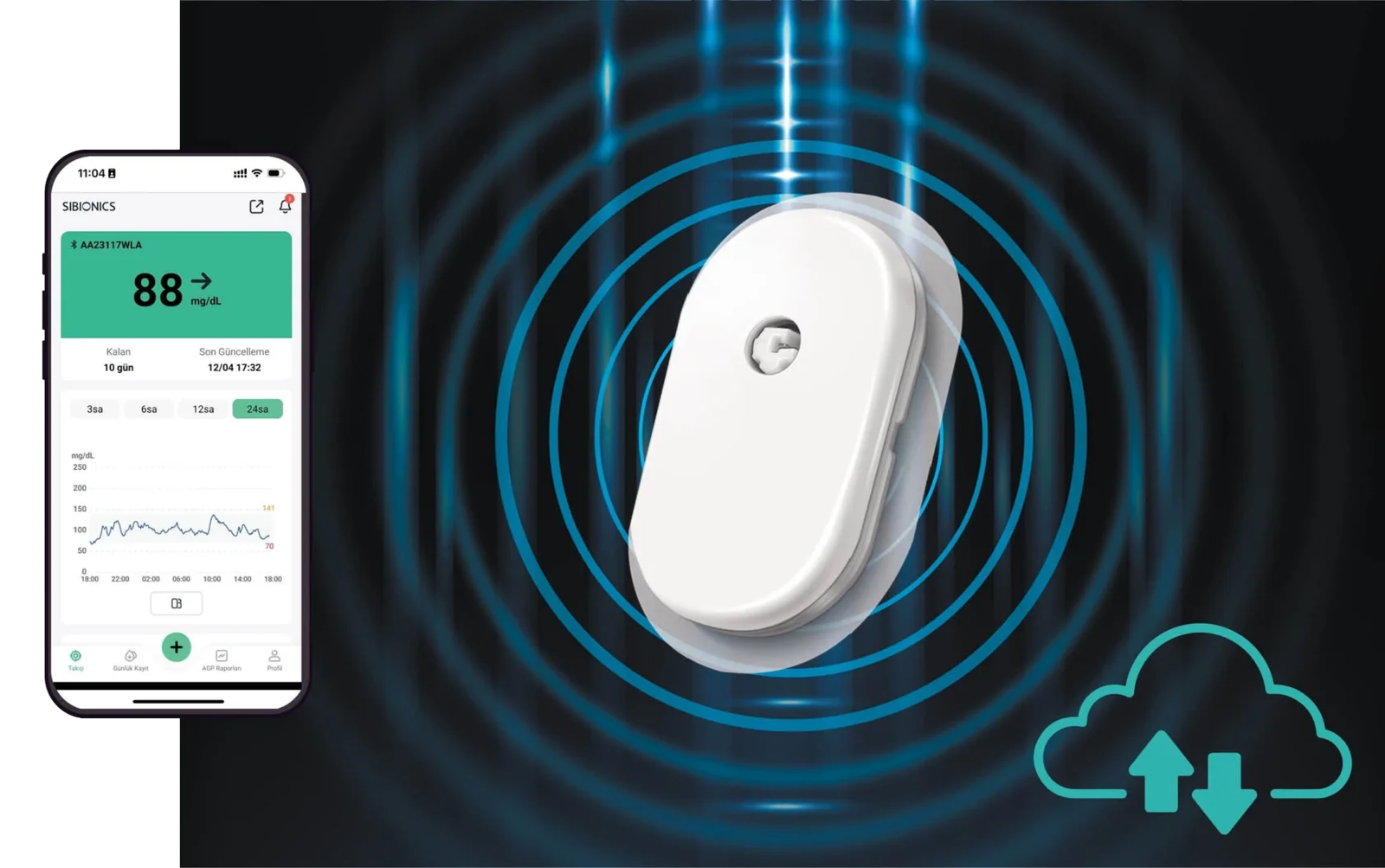 Sibionics Telefon Görseli